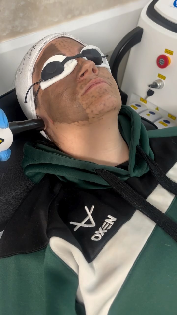 Get that glass-skin glow