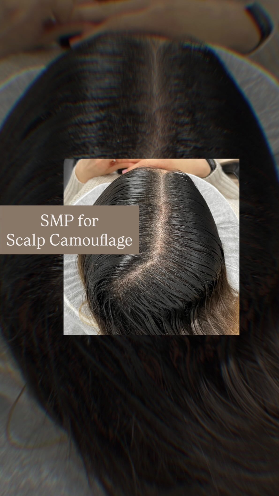 โ๏ธSMP Scalp Camouflage๐๏ธ
Precision Blending for Confidence
โจ Widening part or thinning spots? Letโs make them disappear. Not with temporary cover-ups, but with confidence.
Our Scalp Micropigmentation (SMP) Camouflage technique is designed to seamlessly blend thinning areas, creating the look of fuller, denser hair without surgery or downtime.
Every pigment is matched to your natural tone for a flawless, undetectable result.
Located in Zionsville, Indiana, BLADED Inc specializes in SMP hair restoration for men and women across Zionsville, Carmel and Westfield, and surrounding areas, providing natural-looking coverage that lasts.
โก๏ธ Book your complimentary SMP consultation today! Tap the link in bio or DM โCONFIDENCEโ for availability.
#SMPZionsville #ScalpMicropigmentationIndiana #HairLossSolution #ZionsvilleIndiana #CarmelIN #WestfieldIndiana #BladedInc #HairDensity #LuxuryAesthetic