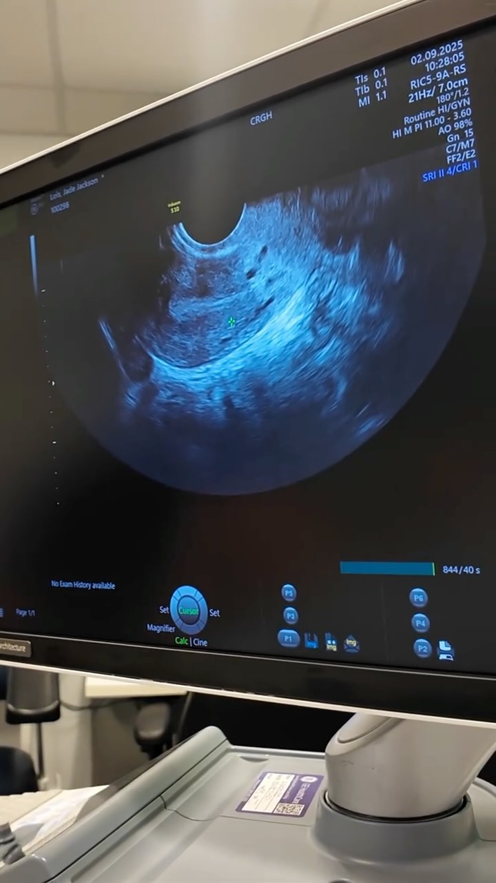 Before I start my IVF injections it’s time to get tested! 🧪
Here’s what @crgh_fertility wanted to find out. The results of these tests impact what treatment you have 👌luckily mine all came back pretty normal. They will do some further tests to find out if I have a polyp but luckily it doesn’t effect the egg retrieval.
Now on to the scary part - injections! My worse nightmare, but something tells me I will get over it after being prodded around so much 😂
#ivfstrongertogether