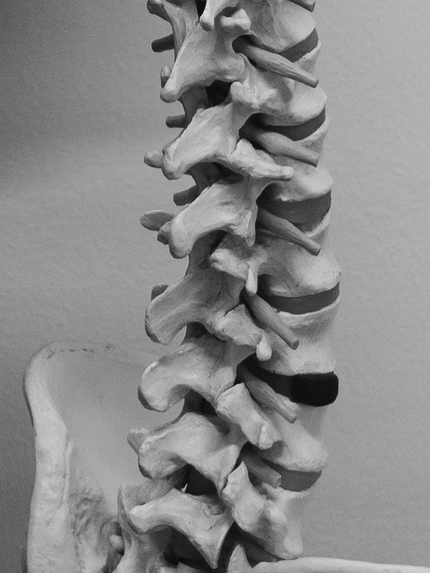 We’ve got your back.
From lower back pain to postural issues, our expert physiotherapists are here to help you move better, feel stronger, and live pain-free.
Personalized treatment plans | Evidence-based care | Support every step of the way 🤝
•
•
•
#physiotherapy #pretoria #lowerbackpain