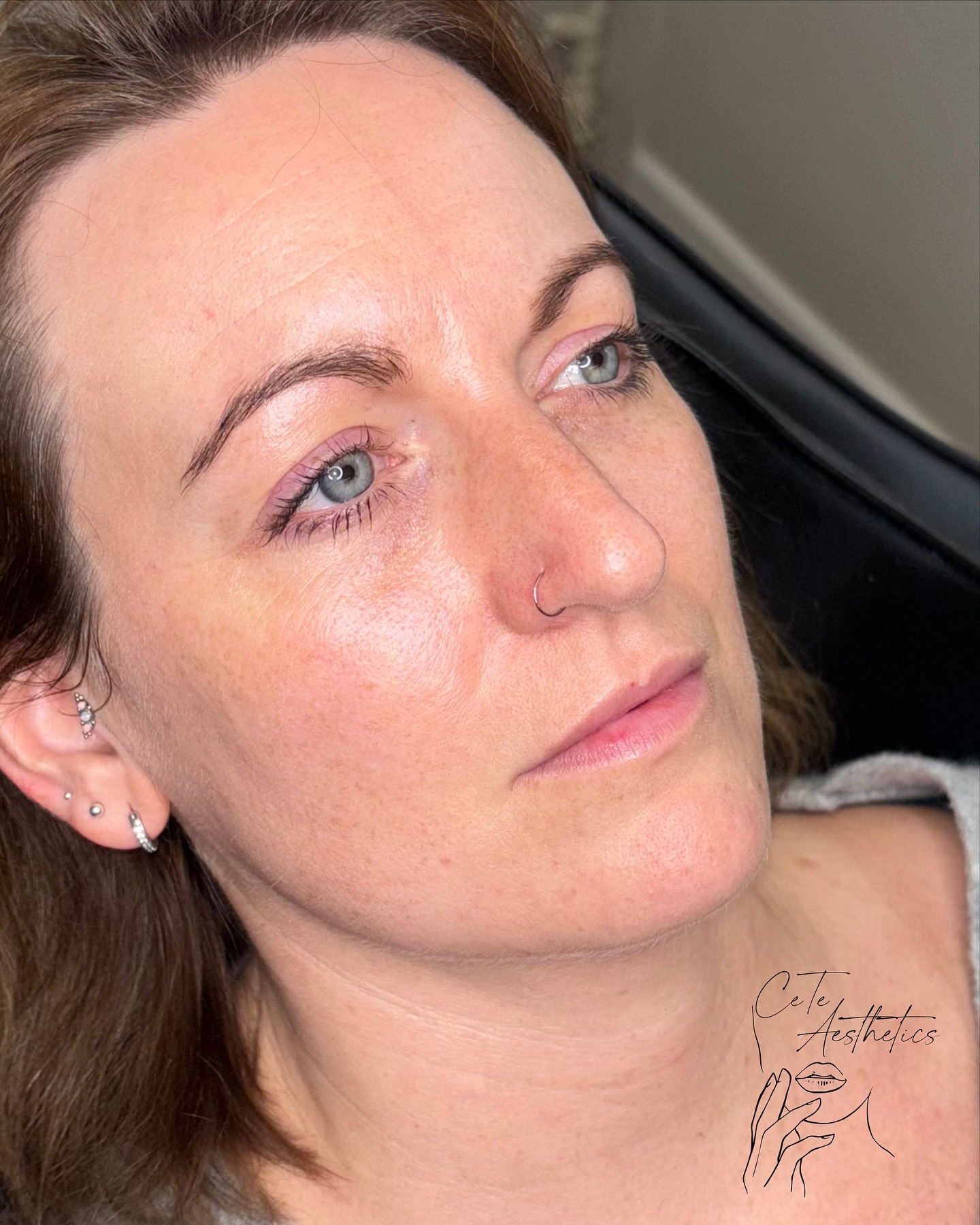 Glass skin in a syringe 💧
Formulated with high-strength hyaluronic acid, Seventy Hyal deeply hydrates and improves elasticity — giving your skin that fresh, healthy glow from within ✨
🌐 www.ceteaesthetics.co.uk