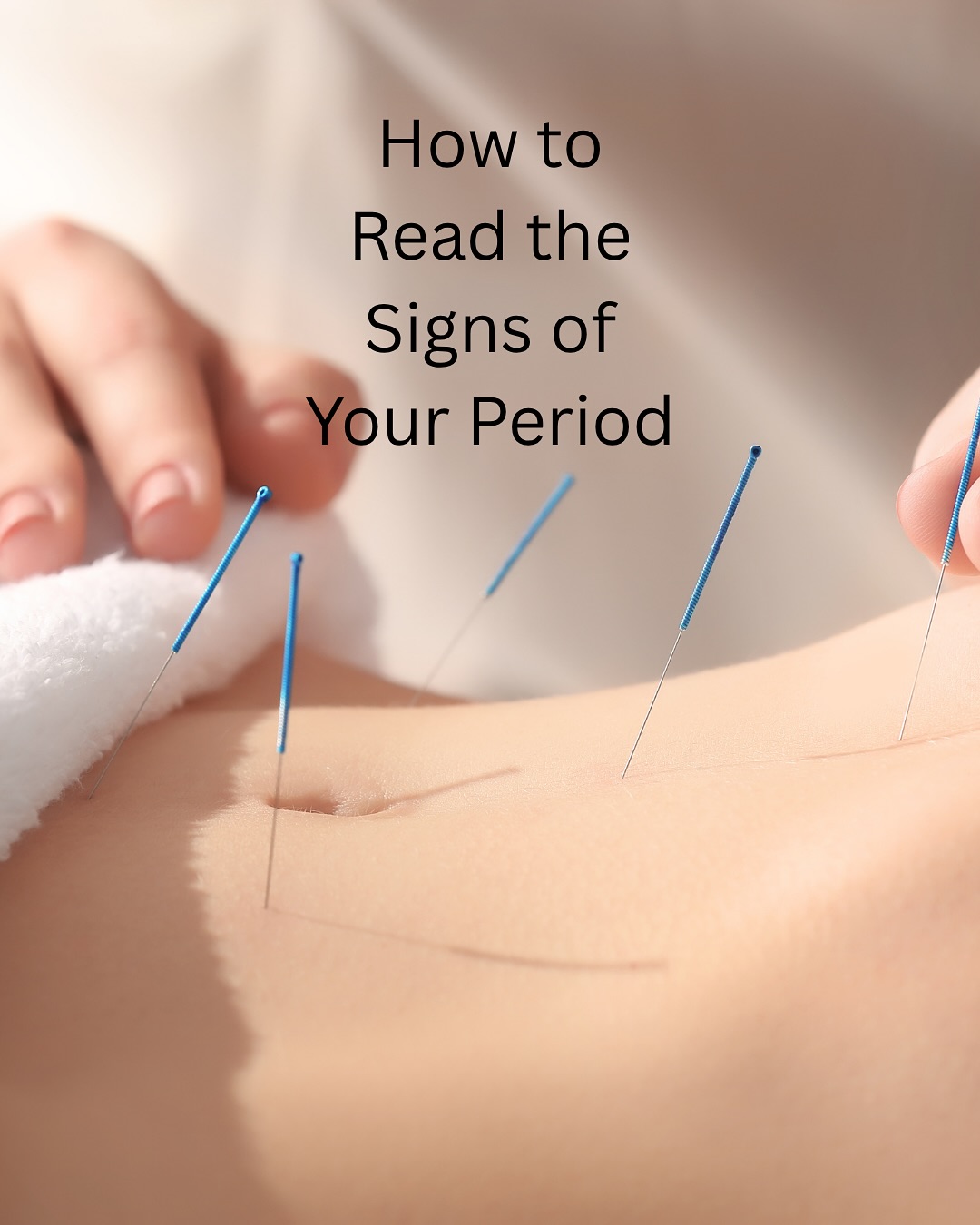 💭 Our bodies are always communicating, periods included. When you pay attention to timing, flow, pain, and mood, you start to see patterns that point to what’s actually off (hormone timing, thyroid shifts, inflammation, Liver Qi stagnation, Blood deficiency, Damp-Heat, and more).
👉 Reading these signs gives you direction: confirm ovulation, stabilise blood sugar, support thyroid and liver, nourish Blood, soothe Liver Qi, and use acupuncture strategically.
Work at the root, not just chase symptoms. Save this for your next cycle check-in.
#periodhealth #womenshealth #hormonehealth #cycletracking #naturopathy #acupuncture #TCM #pcosawareness #endometriosisawareness #thyroidhealth #lutealphasesupport #inflammation #melbournewellness #skinfromwithin