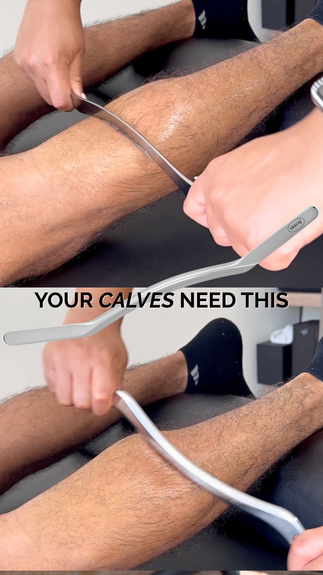 Every tool I use in your session has a purpose—and today, that purpose was Calf x Muscle Scraping 👇🏽
This tool allows for deep, controlled strokes that target dense muscle tissue like the calves—helping to reduce tension, improve circulation, and restore mobility.
I’m always intentional about what I bring into the treatment room.
Backed by research and trusted by professionals worldwide, this tool supports the level of care and results I aim to give every client.
It’s about delivering value through both expertise and the tools that support it 🎯
💬 Got tight calves or nagging tension?
Let’s work on it!
#ReactiveResults #SportsTherapyBDA #MuscleScraping #CalfRecovery #Bermuda