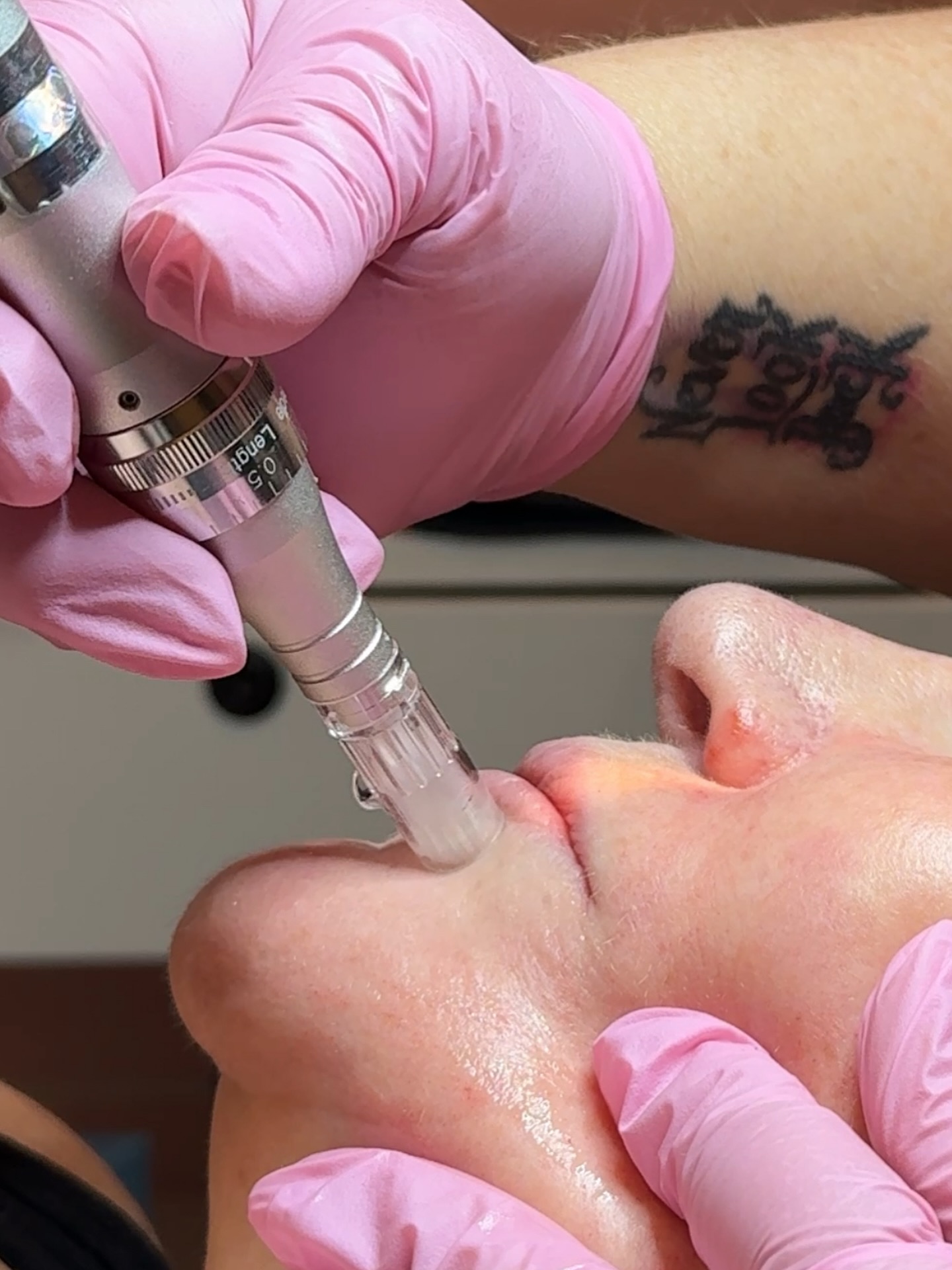 No glow hits quite like a microneedling glow โจ
#denveresthetician #esthetician #microneedling #glowyskin #skincare #denverlocal