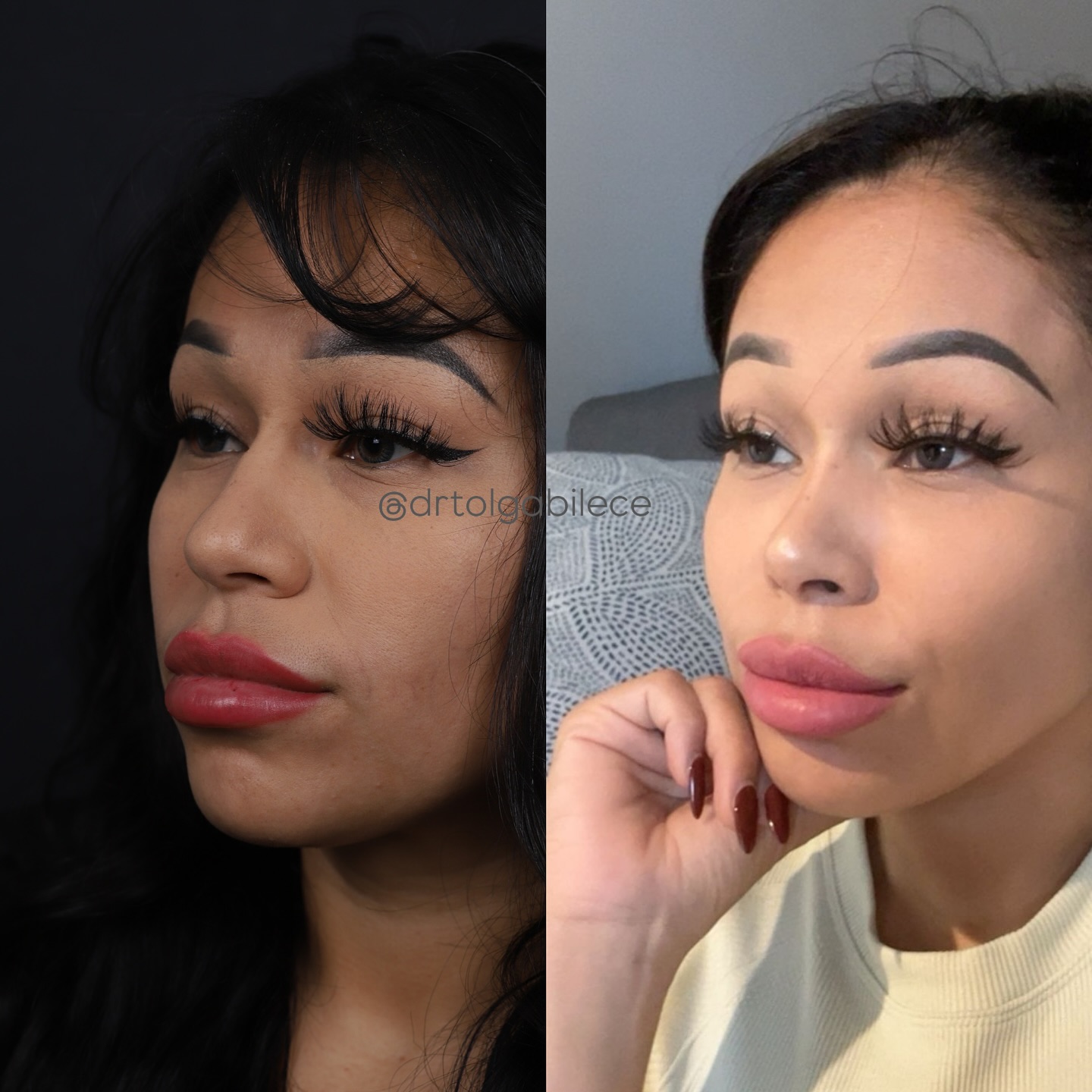 reduction💪💪
⭐️⭐️
@cynthia_v1