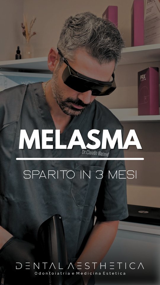 Sapevi che puoi dire addio al melasma con in 3 mesi?
Protocollo:
⚡️6 sedute di laser non ablativo
💧5 sedute PRX
Trattamento non invasivo, indolore e senza aghi.
Dental Aesthetica
📍 viale della Grande Muraglia 256 - zona EUR Torrino
📱 3758847069