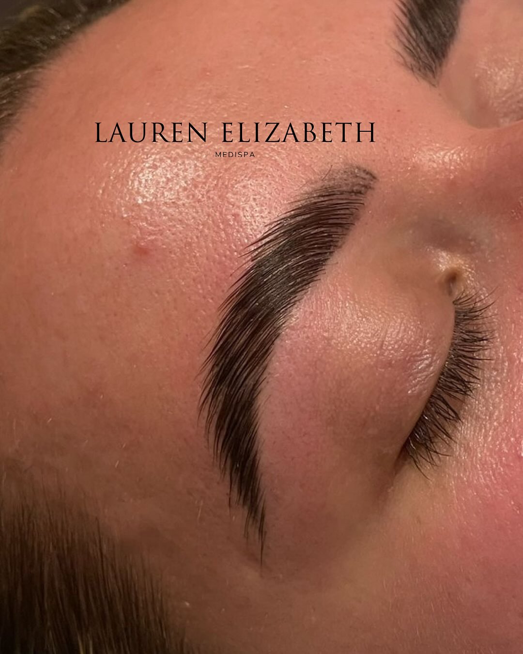 The Art of the Perfect Brow. ✨
Experience the difference of expertly sculpted, naturally beautiful brows 🤎
This is more than a treatment — it’s a beauty statement! Add on Brow Jelly mask for extra relaxation and skin soothing ✨
📅 Limited appointments available.
Reserve your brow experience today.
Dm us “BROWLAM” to secure your slot today or use the booking link in our bio.
#LuxuryBeauty #BrowLamination #RefinedBeauty #FlawlessBrows #SalonExperience #BeforeAndAfter #wokingsalon #medispa