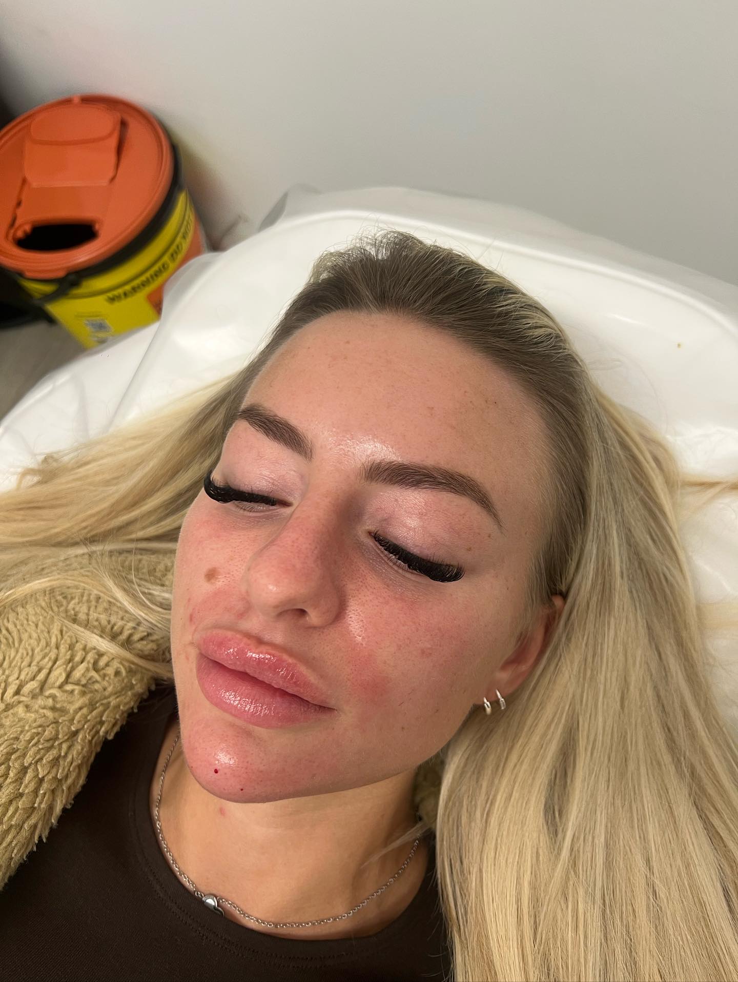 💉 Enhance your jawline with Chin Filler💉
Define your profile and create a more balanced, contoured look.
❗️Only £99 for 1ml❗️
📍Available at The Beauty Lab North East
📍Locations: South Shields & Felling
Treatment carried out by Senior Aesthetics Practitioner Rachel
#thebeautylabnortheast #chinfillers #jawlineenhancement #aesthetics #dermalfillers #southshields #felling #northEastaesthetics #rachelaesthetics #confidenceboost #beforeandafter #facialcontouring #beautyclinic