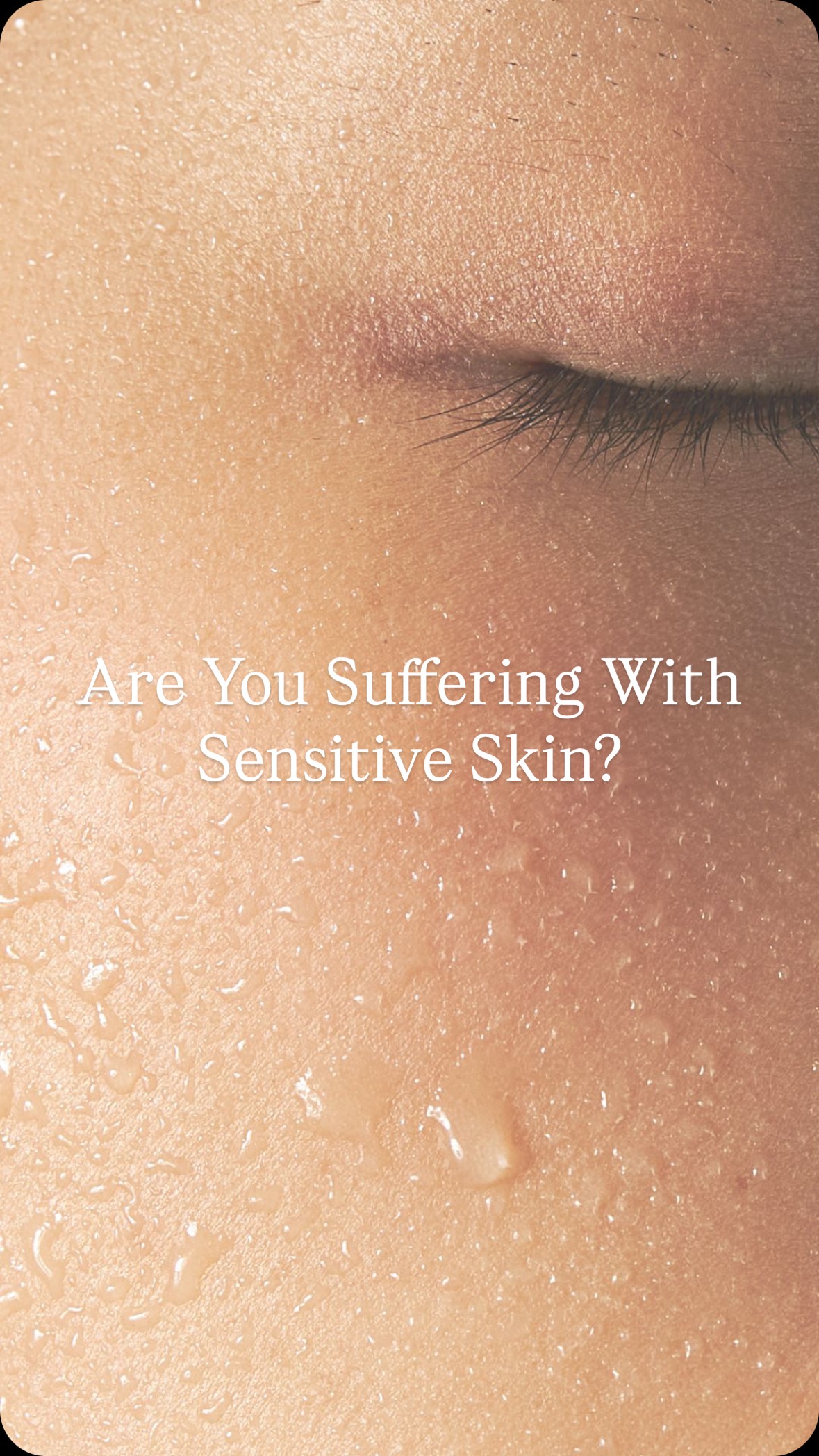 Did You Know, Sensitive Skin Isn’t A Skin Type 👀
🙁 Many clients come to me with concerns of having a sensitive skin type, but actually your skin isn’t born sensitive, it develops into becoming sensitive because of many factors.
❌ Improper use of skincare and worshipping the sun are 2 large factors when it comes to damaging your skin barrier.
🤍 I love it when a client comes to me with sensitive skin, as there’s nothing more I find satisfying, than helping a clients skin barrier recover and become strong, healthy and hydrated.
To achieve this, we’ll simplify your skincare routine, introduce the right active ingredients, and pair them with a tailored course of in-clinic treatments and your skin will truly have never felt happier.
SEND this to someone who is suffering with sensitive skin.