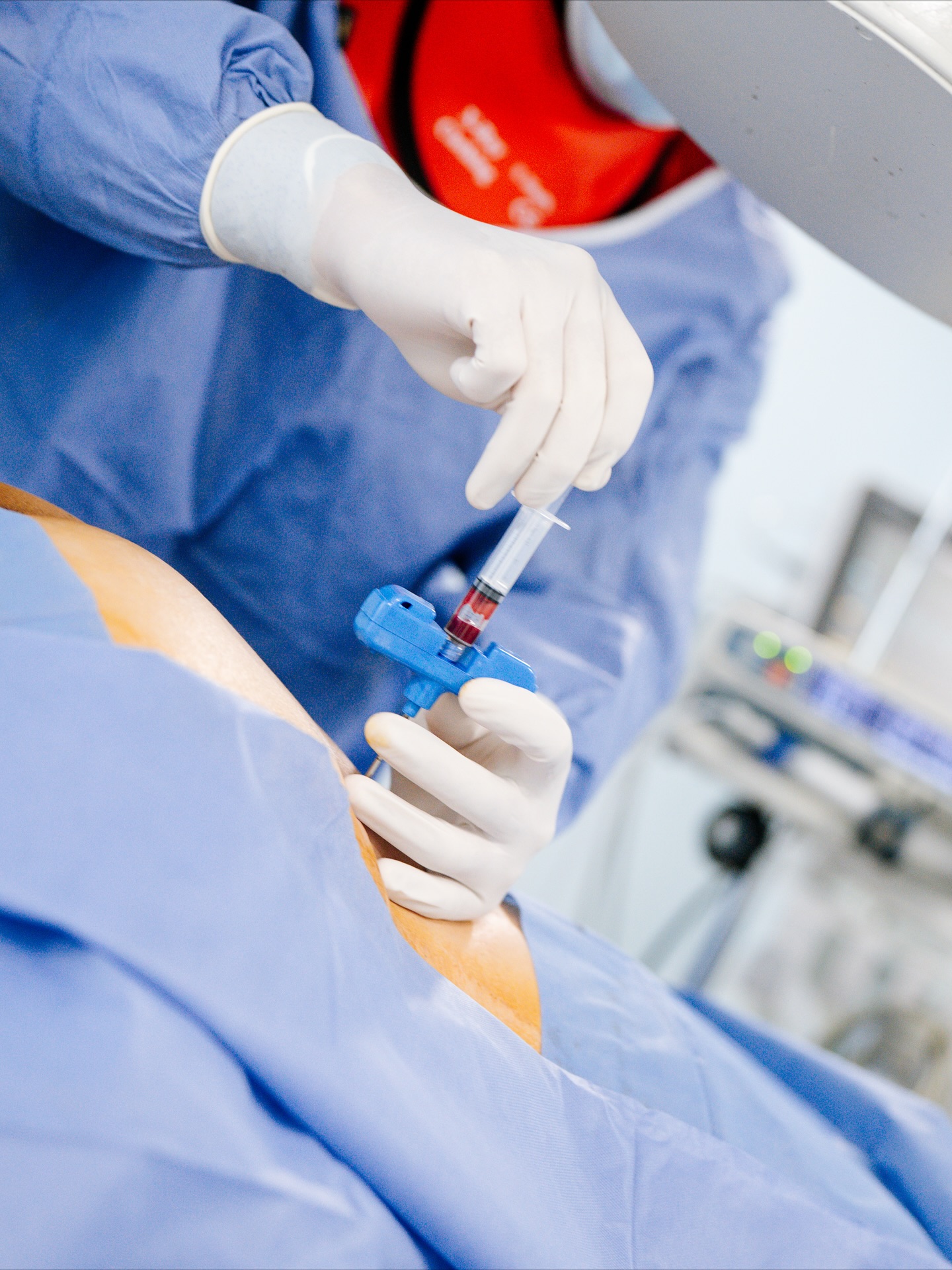 🩺 Más allá del dolor, está la vocación de aliviarlo.
Cada caso es distinto, cada paciente tiene una historia, y detrás de cada procedimiento hay un propósito: devolver calidad de vida.
La Medicina del Dolor no solo se trata de técnicas o bloqueos, sino de escuchar, entender y acompañar a quien busca recuperar movimiento, descanso y bienestar.
En el quirófano, el enfoque está en la precisión.
Fuera de él, en la empatía.
Ambos caminos se encuentran en un mismo objetivo: ayudar a que el dolor deje de ser el centro de tu vida.
👨⚕️ Dr. Alan Valente Gálvez Luna
Especialista en Medicina del Dolor y Algología
📍 Consultorios:
• Plaza Cititower, Guadalajara, Jal.
• Cráter 10, Guadalupe, Zac.
📲 Guadalajara: +52 1 33 4675 6141
📲 Zacatecas: +52 1 492 268 8645
#MedicinaDelDolor #DrAlanGálvez #Algología #DolorCrónico #Bienestar #SaludIntegral #CuidarSinDolor #VocaciónMédica