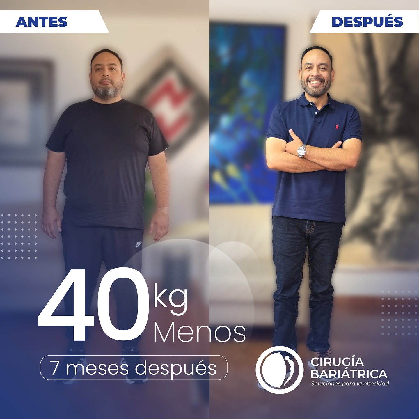 ✨ 40 kilos menos en 7 meses, y una vida llena de energía, alegría y satisfacción.
Gracias a la cirugía bariátrica del Dr. Eduardo Bolaños y su equipo, este paciente no solo transformó su cuerpo, sino también su sonrisa y su calidad de vida. 💙
✨ 88 lbs down in just 7 months — and a life now filled with energy, joy, and total satisfaction.
Thanks to Dr. Eduardo Bolaños and his bariatric surgery team, this patient not only transformed their body, but also their smile and overall quality of life. 💙
#health #healthy #healthandwellness #weightlosssupport #weightlossjourney #weightlossstory #bariatric #bariatricsurgery