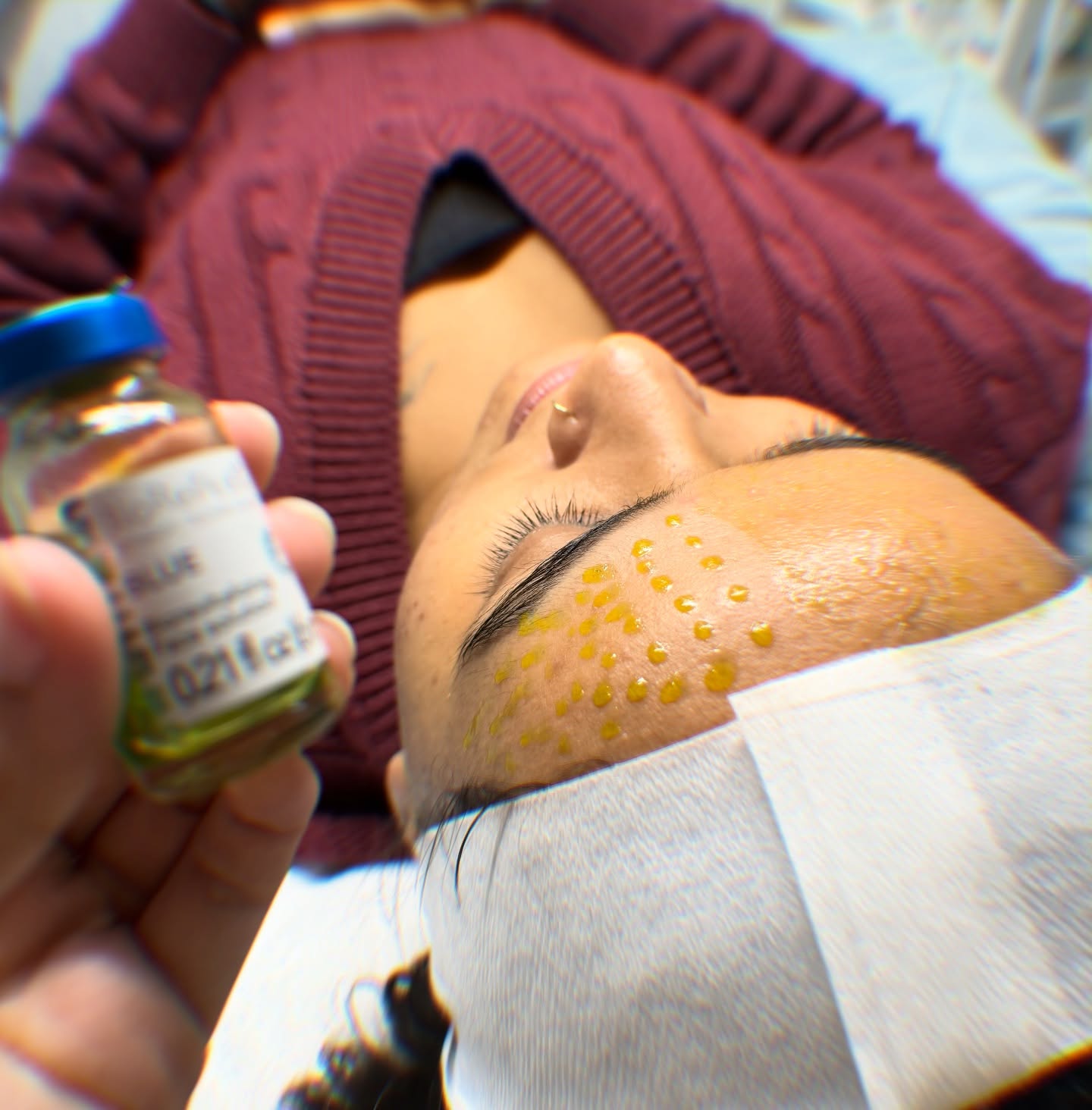 BioRePeel helps exfoliate, renew, and brighten your skin — with zero downtime.
Perfect for dull or tired skin!
#BioRePeel #NoDowntimePeel #SkinRenewal #RadiantSkin #GlowTreatment #SkinCareProfessionals #surrey #delta #love #life #canada #skincareroutineisamust #skincareroutine #skingoals #loveforskincare