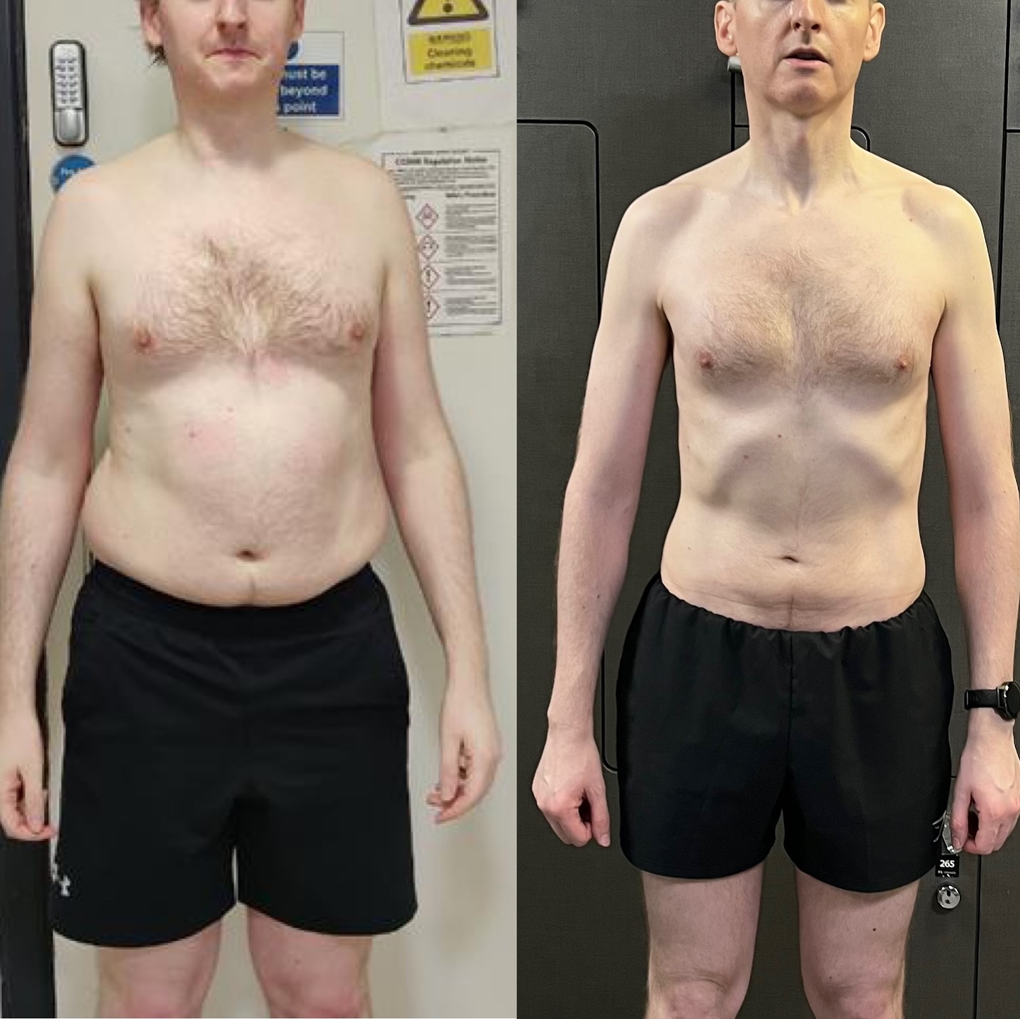 I look better in my 40s than I did in my 20s.
Thatโs what Ian told me after dropping 31lbs of body fat.
And he wasnโt wrong. ๐
He works in Londonโs financial district.
Long days. Back-to-back meetings.
Meals on the go.
That little roll hanging over his jeans had become a daily reminder of how far heโd drifted.
Heโd tried everything โ cutting carbs, joining gyms, hiring trainers, tracking calories โ but nothing stuck.
Because when your scheduleโs full and your energyโs gone, motivation alone wonโt save you.
Every morning heโd look in the mirror thinking,
โHow did I get here?โ
And worseโฆ
โCan I even change this anymore?โ
Thatโs where we started.
We built a system that fit his life.
Simple nutrition.
Heavy, efficient training under an hour.
No fad diets. No endless cardio.
Week by week, the fat melted off.
His confidence came back.
His focus sharpened.
Now heโs in the best shape of his life, in his late 40s.
No tricks. Just structure, accountability, and a system that works for busy professionals.
If youโre ready to drop the excuses and get in the best shape of your life without giving up your lifestyle,
DM me GAINS NOW.
#bodytransformations #fatlosscoach #cityoflondon #menshealth #getshredded #busyprofessionals #busyprofessionalsgetfit #busyprofessionalfitness