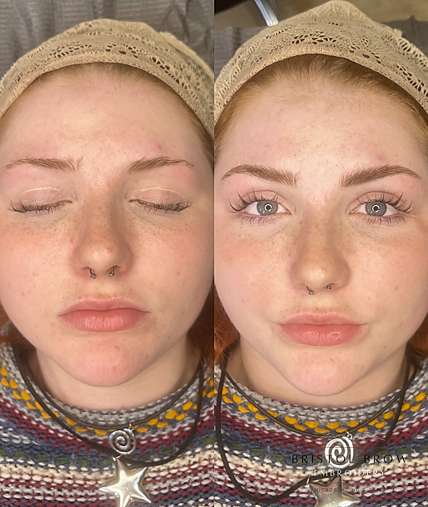 Brows so good, they speak for themselves 😍
_______________________________
🗓️ BOOK NOW - Link in Bio (this shows next Availability)
🌐 Further Information on Services & Prices at www.bristolbrowembroidery.co.uk
🏡 Home-Based Studio in Westbury-on-Trym, Bristol
⭐️ Five Star Google Reviews
💬 DM or Text 07920575556 with further enquires
_____________________________
#hyperrealismbrows
#hyperrealistic #homebasedstudio #bristolmicroblading #bristolbrowembroidery #semipermanentmakeup #microbladingbristol #browsonfleek #bristolbeauty #homebeautystudio #bristolmakeupartist #browtransformation #semipermanentbrows #bristolglam #microbladinguk #homesalon #naturalbrows #sculptedbrows #bristolbeautyservices #bristolbeautytherapist #browenhancement #bristolsemipermanentmakeup #nanobrows #bristolnanobrows #naturalbrows
#BeforeAndAfter #BrowGameStrong #BristolBrows”