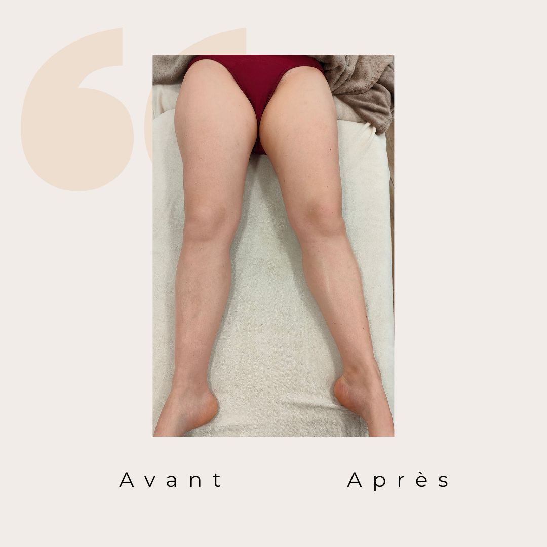 Une séance de drainage lymphatique Renata efficace. Une jambe affiné, une sensation de légéreté retrouvé
#drainagelymphatiquerenata #legerete #massage #bienetre