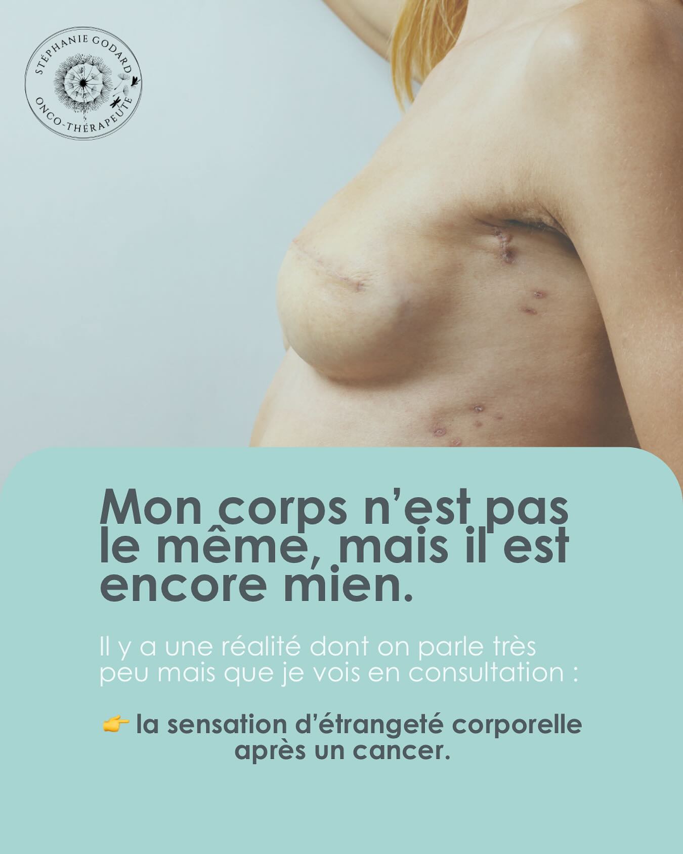 🩷 Mon corps n’est pas le même, mais il est encore mien.
Il y a une réalité dont on parle très peu en consultation :
👉 la sensation d’étrangeté corporelle après un cancer.
Pas la “perte d’estime de soi”, pas la “réconciliation”, pas la “positivité”.
Juste ce fait clinique : votre corps change et votre cerveau met beaucoup plus de temps à l’intégrer.
Ce décalage a un impact énorme sur l’image de soi, le rapport au toucher, à la mobilité, à la fatigue, au regard de l’autre… et pourtant, il reste sous-estimé.
Voici ce que mes patientes me disent le plus souvent et que personne ne leur avait expliqué :
1️⃣ On peut être en rémission et ne plus comprendre son propre corps.
Le corps réagit différemment, parfois de façon imprévisible : douleurs, tensions, modifications sensorielles, fatigue neuromusculaire.
Ce n’est pas “dans la tête”.
👉🏻C’est un phénomène d’incongruence corporelle : le cerveau a du retard sur la transformation physique.
2️⃣ Se regarder dans le miroir peut devenir un moment technique, pas émotionnel.
Beaucoup me disent : “Je me regarde pour vérifier, pas pour me reconnaître.”
👉🏻C’est un signe que le cerveau est encore en mode monitoring, pas en mode identité.
3️⃣ On peut se sentir fonctionnelle… mais pas “habiter” vraiment son corps.
Faire les gestes, tenir le quotidien, reprendre les activités… Et malgré ça, avoir la sensation que le corps est “en prêt”, “en transition”, “en mode surveillance”.
👉🏻Cette dissociation n’est pas un échec :
c’est un mécanisme d’adaptation après un choc corporel majeur.
4️⃣ La réappropriation corporelle n’est pas un objectif esthétique.
C’est un enjeu de sécurité intérieure. Ce n’est pas une question d’aimer son corps. Mais de retrouver un sentiment d’ancrage, de cohérence, de fiabilité même minimale.
Parce que pour se sentir en paix, il est nécessaire d’abord se sentir “dedans”.
👉 Qu’est-ce qui vous surprend le plus dans votre corps aujourd’hui ?
#corps #reconstruction #identitécorporelle #aprescancer #estimedesoi #estimedesoicancer #reconstructionidentitaire #cancer #remission #oncoaching #oncothérapeute