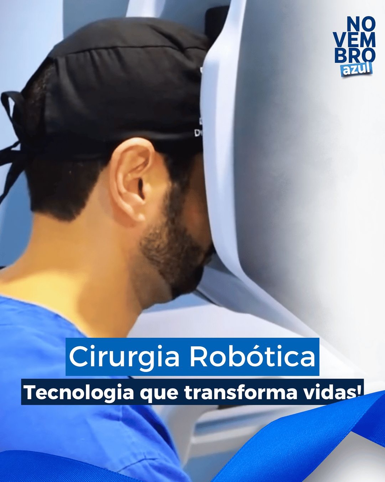 A cirurgia robótica representa o que há de mais avançado na urologia moderna.
Com o auxílio do sistema Da Vinci, o cirurgião tem visão em 3D ampliada, movimentos mais precisos e menor trauma aos tecidos, o que significa:
✅ Menor sangramento durante o procedimento
✅ Menos dor no pós-operatório
✅ Recuperação mais rápida
✅ Alta hospitalar precoce
✅ Resultados funcionais e oncológicos mais seguros
Na urologia, a cirurgia robótica é amplamente utilizada em procedimentos como:
– Prostatectomia robótica (retirada da próstata)
– Nefrectomia robótica (retirada parcial ou total do rim)
– Cistectomia robótica (retirada da bexiga)
A tecnologia é uma aliada na luta contra o câncer de próstata, oferecendo qualidade de vida e esperança a muitos pacientes. 💙
#NovembroAzul #CirurgiaRobótica #Urologia #SaúdeDoHomem #CâncerDePróstata
