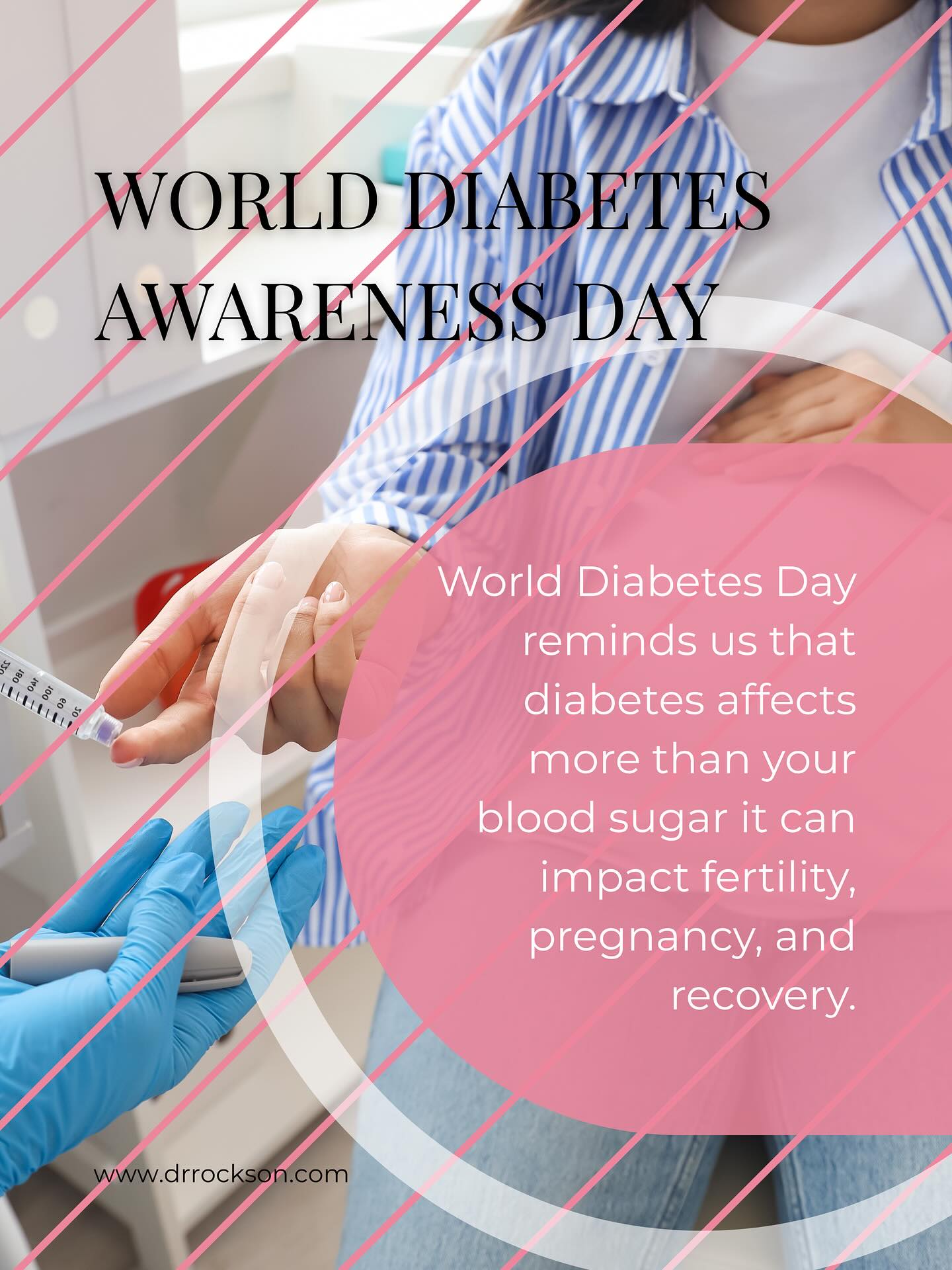 💙 World Diabetes Day reminds us that diabetes affects more than just your blood sugar — it can also impact fertility, pregnancy, and recovery.
🌸 Poorly controlled diabetes can disrupt ovulation, increase infection risk, and lead to pregnancy complications.
🩺 The good news? With regular screenings, a balanced diet, and consistent exercise, women can manage diabetes and live full, healthy lives.
👩🏽⚕️ Book your women’s wellness consultation today.
#worlddiabetesday #hormonalhealth #fertilityawareness #drestherrockson #womenswellness