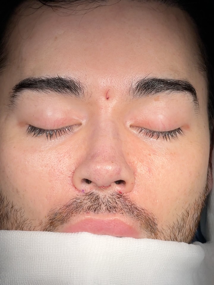 definition💪💪
from the USA🇺🇸
low radix was supported❗️