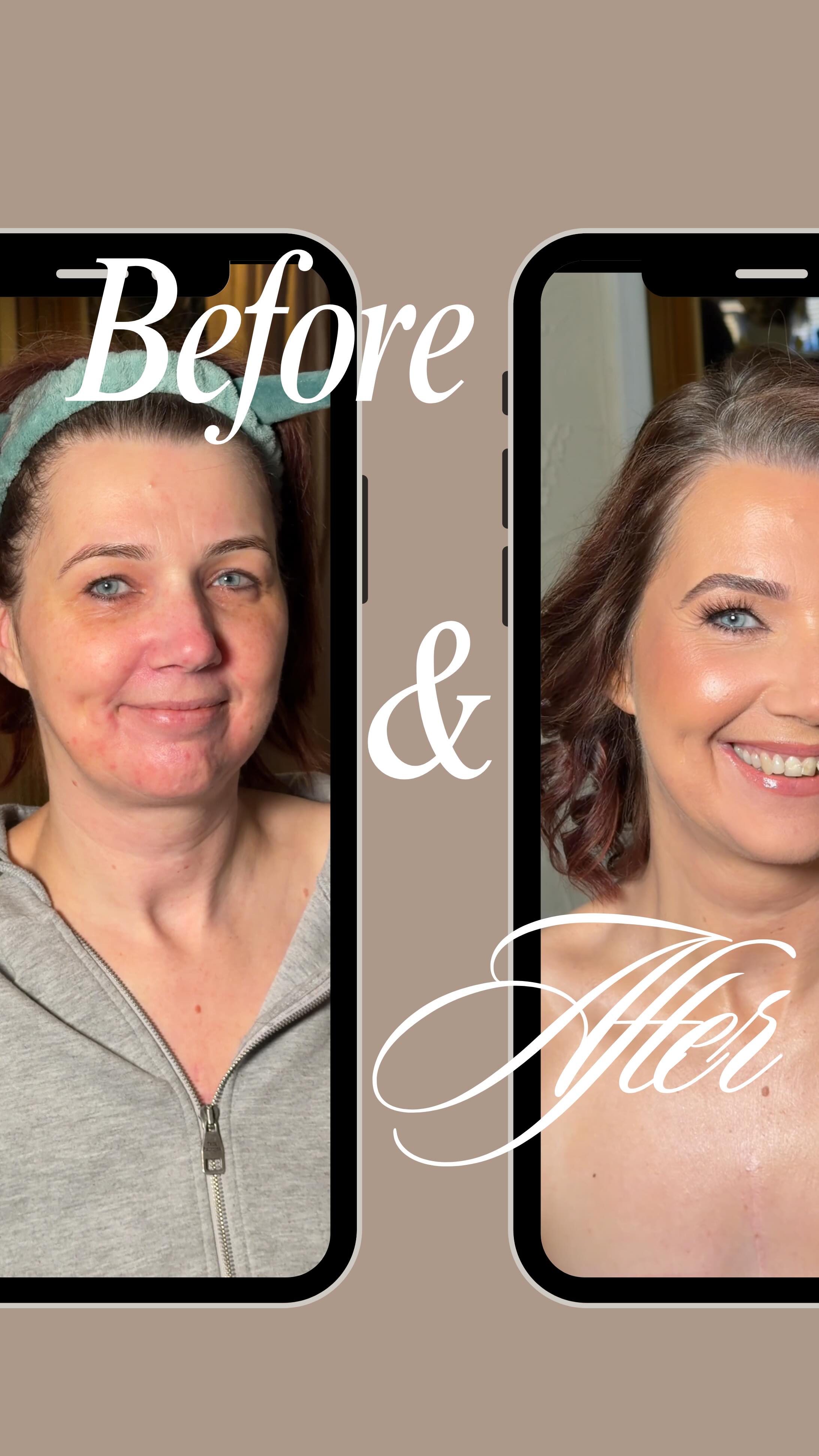 This is your reminder that great makeup starts before the brush ever hits your face.
My lovely bride struggled with eczema in the run-up to her wedding, and we worked together on a simple, soothing skincare routine that calmed everything right down.
And look at her now… glowing, confident, comfortable, and absolutely radiant! ✨
Good skin isn’t about perfection — it’s about preparation, patience and the right guidance.
If you’ve got sensitive or reactive skin, I promise you: you can still have flawless wedding makeup.
We’ll build the routine together 🤍
#beforeandaftermakeup #norwichmua #norfolkmua #norwichmakeupartist #norfolkmakeupartist #bridalmakeup #norfolkhairandmakeupartist #suffolkmua