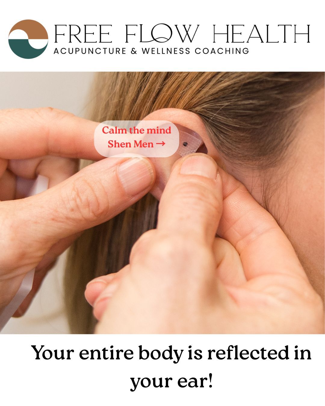 Auricular (ear) acupuncture is a microcosm of the body, meaning every organ, system, and emotion has a corresponding point on the ear.
✨ For example:
The ear lobe relates to the head and face (great for headaches, jaw tension, and stress).
The concha (center of the ear) connects to internal organs like the heart, lungs, and digestive system.
The upper rim reflects the spine and limbs, often used for back or joint pain.
Stimulating these points with tiny acupuncture needles or ear seeds (often made of vaccaria seeds or gold/silver pellets) sends signals through the vagus nerve, calming the nervous system and helping the body self-regulate.
🌿 Ear acupuncture can support:
Stress, anxiety, and insomnia
Pain anywhere in the body
Hormonal balance
Cravings and emotional regulation
And ear seeds make it easy to continue treatment between sessions — a simple, gentle reminder that healing is always within reach.
✨ Tiny points, big impact.
#auricularacupuncture #earseeds #vagusnerve #stressrelief #acupunctureworks #sandiegowellness #chinesemedicine #nervoussystemhealth #freeflowhealth #hormonebalance