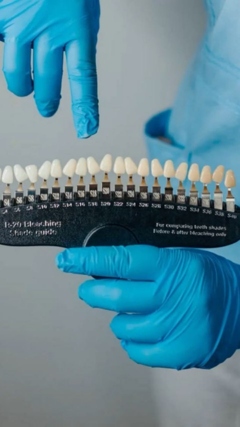 Sabías que un blanqueamiento dental profesional puede aclarar tu sonrisa varios tonos sin dañarla?
Este es un resultado real obtenido en Denticali, con una técnica segura, supervisada y personalizada para cada paciente.
🔹 Reducción de manchas
🔹 Sonrisa más luminosa
🔹 Resultados visibles
🔹 Cuidado de la sensibilidad
Tu sonrisa merece lo mejor.
📩 Agenda tu valoración
📍 Denticali
#blanqueamientodentalclinico #sonrisaluminosa #denticali #odontologiaestética #antesydespués #odontologiacali #diseñodesonrisa