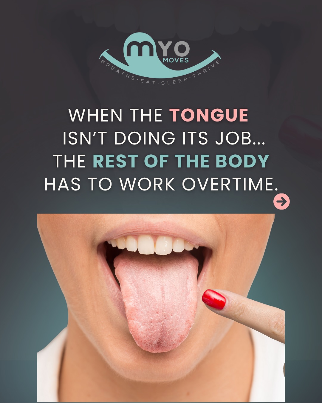 When the tongue isn’t doing its job… the rest of the body has to work overtime. And that overtime shows up in ways most people never connect back to the tongue!
❌ Mouth breathing
❌ Poor sleep quality
❌ Narrow palate + facial growth changes
❌ Digestive discomfort
❌ Low energy or difficulty focusing
A dysfunctional tongue doesn’t just stay in the mouth, it affects posture, airway, sleep, and overall regulation. It’s all connected!
✨ Myofunctional therapy helps restore proper tongue posture and function so you (or your child) can breathe better, sleep deeper, and feel better everywhere.
👇 Drop YES AIRWAY in the comments if you’re ready to start your airway health journey.