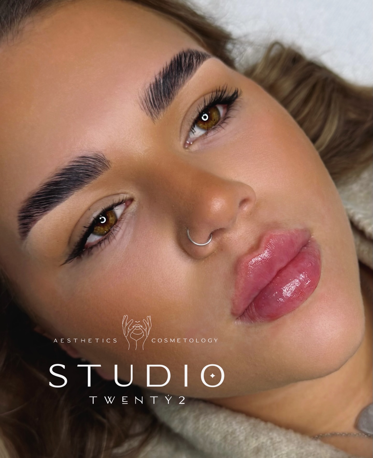 Our gorgeous Sophie 🥰💋
The perfect example of how annual lip maintenance keeps your results fresh, balanced and beautifully enhanced ✨
Her lips look absolutely incredible all ready for mistletoe season 😘🤭
Soft, glossy, hydrated and perfectly shaped with zero overfilling. A subtle top up once a year helps maintain definition, volume and symmetry while keeping everything looking natural and refined.
Whether you’re looking for your first treatment or due your yearly refresh, StudioTwenty2 specialises in beautiful results, expertly delivered 💫
#StudioTwenty2 #LipFiller #LipEnhancement #FillerResults #AestheticsClinic #NaturalAesthetics #SubtleEnhancement #AestheticPractitioner #LipGoals #BeforeAndAfter #GlossyLips #DermalFillers #AestheticsUK #Cosmetology #EnhanceYourBeauty #ConfidenceBoost #SkinAndInjectables #BeautyClinicUK #AnnualTopUp #NaturalResultsOnly