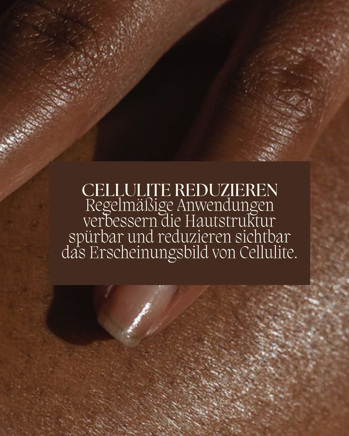 Cellulite – Was wirklich dahintersteckt
Cellulite ist kein Schönheitsfehler und keine Krankheit. Sie ist eine natürliche Veränderung des Bindegewebes, die vor allem bei Frauen vorkommt – unabhängig von Körperform oder Gewicht. Das weibliche Bindegewebe ist weicher, elastischer und hormonell beeinflusst, wodurch Fettzellen leichter an die Oberfläche treten können.
Wenn Faktoren wie Stress, wenig Bewegung, Wassereinlagerungen, hormonelle Schwankungen, mangelnde Durchblutung oder ein träges Lymphsystem dazukommen, wirkt die Haut uneben oder “dellig”.
Cellulite entsteht also nicht einfach “von außen”, sondern im Inneren:
• Das Lymphsystem arbeitet langsamer.
• Gewebe staut sich.
• Fettzellen verhärten oder vergrößern sich.
• Die Durchblutung nimmt ab.
Das Positive: Cellulite kann sichtbar verbessert werden, wenn Stoffwechsel, Lymphe und Gewebestruktur aktiviert werden. Genau hier setzt die Madero-Therapie an
#madero #lipodem #lymph #lymphaticdrainage #lipo #massage #münchen #blackfridaydeals