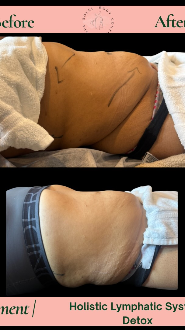 ✨ If you needed a sign to start snatching that waist… this is it, babe. 😉