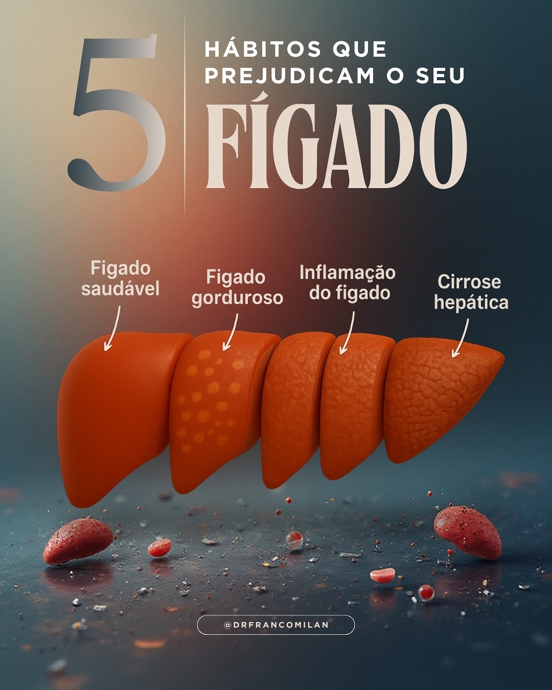 🟣 Seu fígado sente tudo — até o que você não percebe!
Muita gente só lembra do fígado quando aparece um sintoma, um exame alterado ou um diagnóstico inesperado.
Mas a verdade é: seu fígado trabalha em silêncio todos os dias, filtrando toxinas, metabolizando nutrientes e mantendo seu corpo em equilíbrio.
Cuidar dele não é sobre exageros — é sobre consistência. Pequenas escolhas repetidas ao longo do tempo fazem toda a diferença para evitar inflamação, gordura no fígado e outras doenças silenciosas.
Priorize equilíbrio, rotina e acompanhamento médico.
Seu fígado agradece — mesmo que você não perceba. 🩺
#FígadoSaudável #SaúdeDoFígado #Hepatologia #Médico #RotinaSaudável #VidaSaudável #SaúdeIntestinal #BemEstar #Medicina #CuideDoSeuCorpo