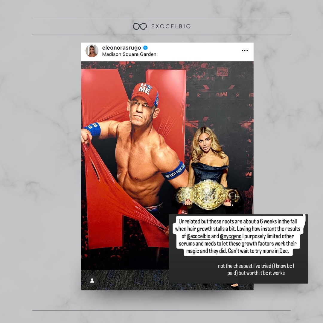 “Unrelated but these roots are about a 6 weeks in the fall when hair growth stalls a bit. Loving how instant the results of @exocelbio and @nycgvno I purposely limited other serums and meds to let these growth factors work their magic and they did. Can’t wait to try more in Dec.
not the cheapest I’ve tried (I know bc I paid) but worth it bc it works”
We love seeing exovex+ Hair become part of the routines that professionals trust! 🧬✨
#exosomes #exosometechnology #exosometherapy #hair #hairrejuvenation #hairgrowth
Exocel Bio’s exosome products are topical cosmetic solutions designed to support post-procedure skincare. These products are not drugs and are not intended to diagnose, treat, cure, or prevent any disease or medical condition. Exocel Bio manufactures its products in a GMP- and ISO-certified cleanroom facility and follows applicable FDA guidelines for cosmetics. To ensure quality and safety, EXOVEX undergoes third-party testing by independent laboratories to verify content, quantity, and quality. These products are for external topical use only and should not be injected or administered intravenously. The statements in this communication, including but not limited to brochures, emails, websites, and social media posts, have not been evaluated by the U.S. Food and Drug Administration (FDA). Individual results may vary.
All trademarks, copyrights, and intellectual property belong to Exocel Bio. ©️2025 Exocel Bio. All rights reserved.