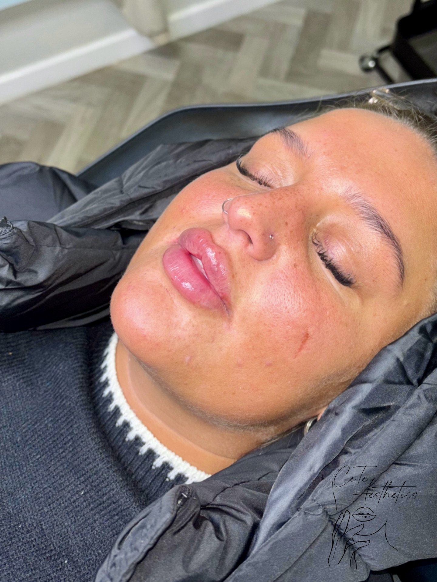 Advanced full lip enhancement focusing on definition, symmetry, and smooth volume 🫶🏽
Festive savings, flexible booking on our website
www.ceteaesthetics.co.uk
Secure the offers now, enjoy it whenever you wish 💫
-
#CeteAesthetics #ScunthorpeAesthetics #NorthLincolnshireClinic