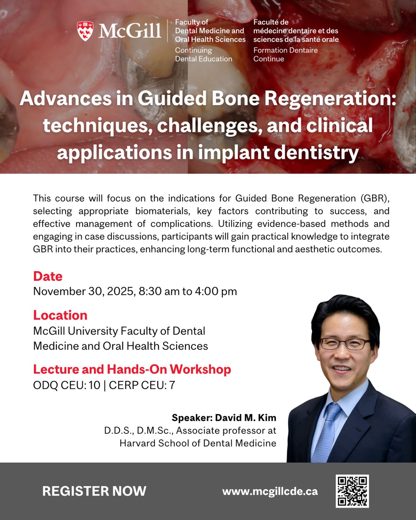 Advances in Guided Bone Regeneration are reshaping implant dentistry — and this McGill Continuing Dental Education course offers a deep dive into techniques, materials, and clinical factors that influence long-term outcomes.
On November 30, 2025, participants will explore indications for GBR, criteria for biomaterial selection, management of complications, and hands-on application across clinical scenarios. The program blends evidence-based insights with case discussions to support stronger decision-making in daily practice.
With Dr. David M. Kim (Harvard School of Dental Medicine) leading the session, attendees gain practical guidance designed to refine procedures and strengthen functional and aesthetic results.
📍 Location: McGill University Faculty of Dental Medicine and Oral Health Sciences
⏰ Time: 8:30 am – 4:00 pm
🎓 CEU: ODQ 10 | CERP 7
👉 Register now and secure your spot.
🔗 www.mcgillcde.ca
#ContinuingDentalEducation #Dentistry #ImplantDentistry #GBR #McGill #DentalCourse #HandsOnWorkshop #ProfessionalDevelopment