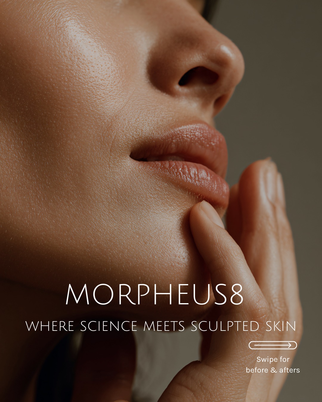 Looking to lift, tighten and transform? ✨
Say hello to Morpheus8, the revolutionary treatment that combines microneedling + radiofrequency to target deep layers of the skin for powerful collagen remodeling.
✅ Smoother skin
✅ Increased collagen
✅ Defined contours
✅ Real confidence
✅ Visible results
Whether you’re looking to refresh your look or address deeper skin concerns, Morpheus8 reshapes your skin from the inside out. This is where science meetings sculpted skin.
Book your personalized consultation today! ✨
#Morpheus8 #HolidayGlow #SkinRejuvenation #ViewLaser #TsawwassenBeauty #SkinTightening #RFMicroneedling