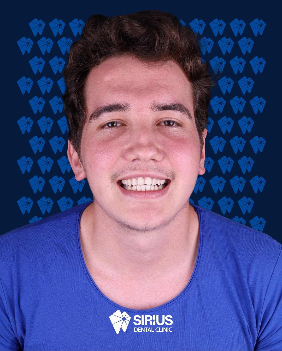 ✨Our patient’s teeth, previously affected by decay, have been restored to their natural appearance with aesthetic fillings.
Supported by a thorough cleaning, the treatment has resulted in a healthy, clean and beautifully natural smile.
🙌We’d like to thank our patient for choosing us.