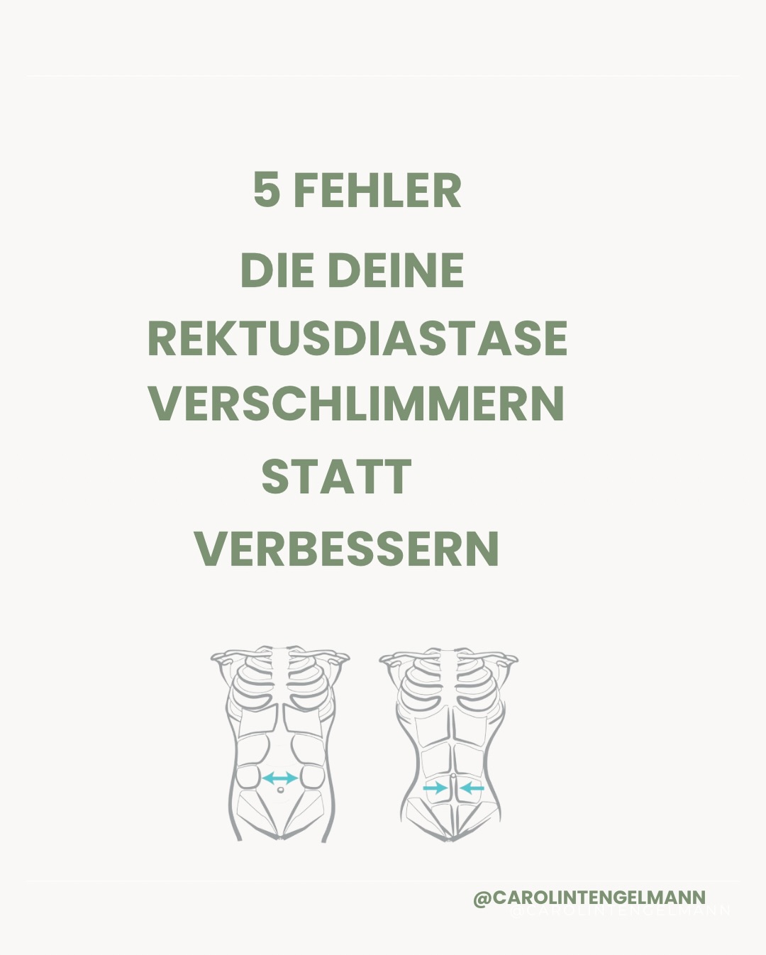 Wenn du diesen Beitrag gesehen hast, dann weißt du es jetzt:
Du hast NICHT versagt.
Du hast einfach nie gelernt, was dein Körper wirklich braucht.
Diese 5 Fehler machen fast alle Frauen, nicht, weil sie ‚unwissend‘ sind, sondern weil ihnen niemand zeigt, wie Heilung bei einer Rektusdiastase wirklich funktioniert.
Und genau deshalb fühlen sich so viele festgefahren:
👉 Du strengst dich an, aber es wird nicht besser.
👉 Du machst Übungen, aber dein Bauch bleibt weich oder wölbt sich.
👉 Du hast Angst, etwas falsch zu machen und machst dann lieber gar nichts.
Die Wahrheit?
Das liegt nicht an dir. Es liegt an der fehlenden Anleitung.
Und genau das bekommst du im Webinar am 03.12.:
✨ Klarheit darüber, was DEIN Körper wirklich braucht
✨ einen Weg raus aus der Überforderung
✨ die Sicherheit, endlich nichts mehr kaputt zu machen
✨ und die Chance, 2026 nicht wieder im selben Kreislauf zu starten
Es ist unser letztes Webinar dieses Jahr.
Nur 20 Plätze.
Die ersten 10 bekommen die Goodies geschenkt.
Wenn du beim Lesen spürst:
„Ich will endlich verstehen, was mein Körper braucht…“
Dann ist das Webinar dein Moment.
❤️ Lass dir diese Gelegenheit nicht entgehen.
Sie kommt erst 2026 wieder.
👉 Link in der Bio / Jetzt anmelden.
Oder kommentiere 🫶 für den Link zur Anmeldung.
Ps: Du bist vor Weihnachten schon in einem anderen Körper. Starte deine Reise jetzt !