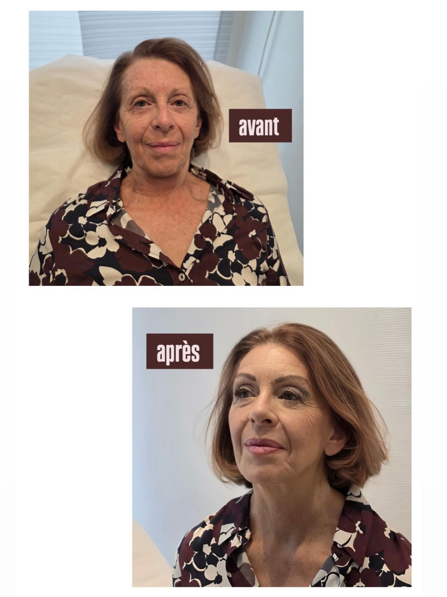 Maquillage pour la maman du marié…🤍
Notre cliente qui n’a pas l’habitude de se maquiller, nous a demandé un maquillage simple et élégant.
Nous avons tenus à faire un maquillage chic et élégant tout en respectant sa personnalité.
Résultat ➡️ Cliente ravie 🥰 #maquillage #mariage #institutdebeaute #imanebeauty #soirée