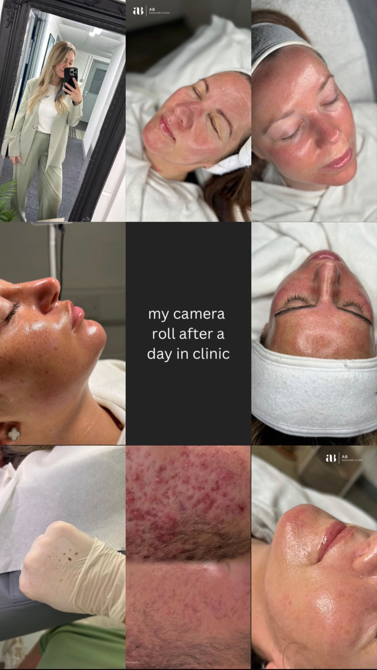 From bespoke treatments to flawless results โ A days camera roll is full of the details that make luxury skincare unforgettable. โจ๐ธ