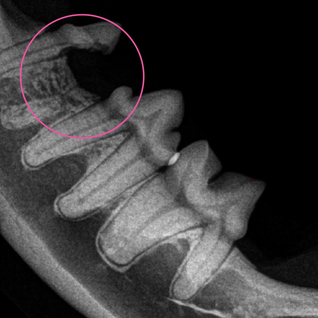 Aua 🤕!
Ein eindrücklicher Fall von Zahnresorption bei einer Katze. Zwischen den beiden Röntgenaufnahmen der Unterkieferbackenzähne liegt nur ein Jahr. Daher schauen wir beim jährlichen Gesundheitscheck immer ins Maul eines Tieres und raten je nach Befund zu einer Zahnuntersuchung mit Röntgenaufnahme in Narkose. Diese Zähne, welche Schmerzen bereiten und nicht erhalten werden können, werden gezogen.
So wird ihr Liebling wieder schmerzfrei nach Hause entlassen.
@tierarztpraxis_rothenburg
#forl #zahngesundheit #katzenzähne #zahnröntgen #zahnoperation
