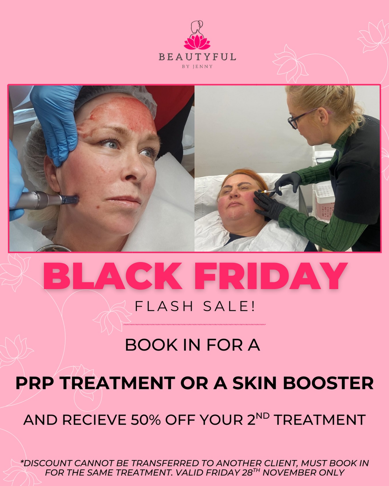 BLACK FRIDAY GLOW UP โจ
Book any PRP treatment or skin booster and get 50% OFF your next session, a saving of up to โฌ150!!
Your second appointment must be for the same service and is non-transferable.
Get your skin glowing just in time for Christmas ๐โจ
Link in bio to book or drop me a message ๐ฅฐ
#blackfridaygreystones #blackfridaywicklow #blackfridayoffers #localoffers