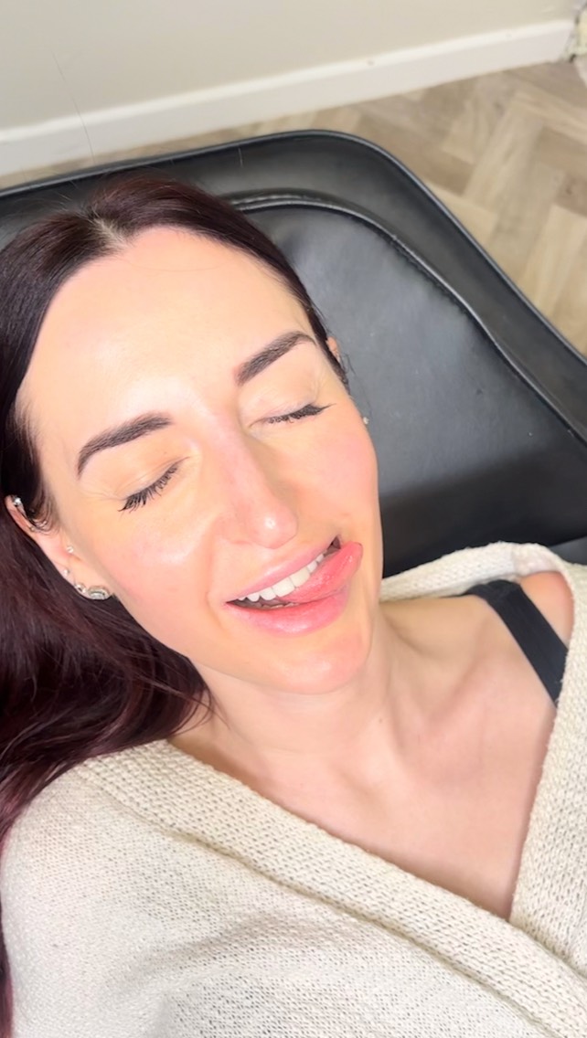 Festive filler glow! 🌟
It’s the season for contouring, confidence & gorgeous definition ✨
To celebrate the festive period, dermal filler packages have £100 OFF. Once you secure it, the discount is yours to use whenever you like, even well after the holidays.
We can treat all areas whether you want a snatched jawline, lifted cheeks, or a soft, natural refresh… now is the perfect time to treat yourself 🎄💉✨
Limited-time festive offer.
Book via our website at www.ceteaesthetics.co.uk or send us a DM
#dermalfiller #scunthorpelipfillers #aesthetics