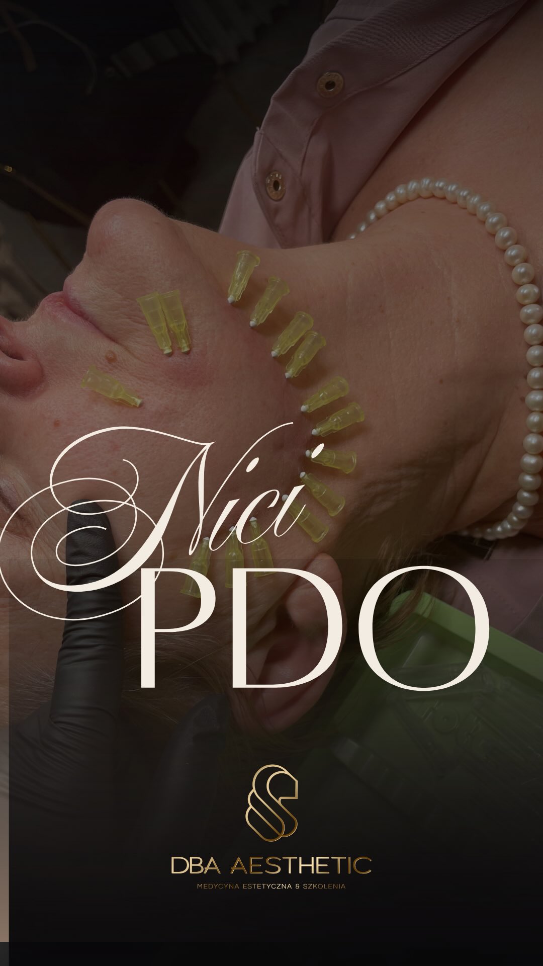 Wybór typu nici to nie moda, tylko logika zabiegowa – oparta na grubości skóry, lokalizacji problemu i celu terapeutycznym. Nie każda twarz wymaga liftingu – czasem potrzebuje tylko wzmocnienia