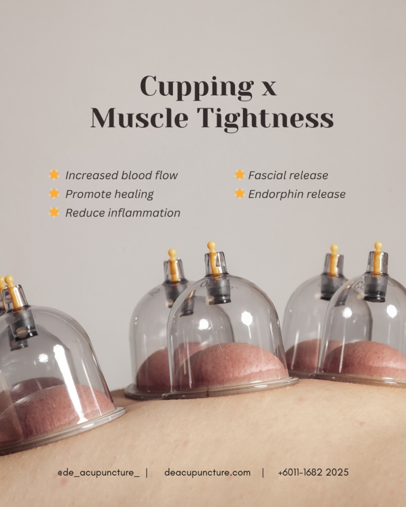 Feeling a bit tight and achy? Cupping might be the answer!
This ancient technique involves placing cups on your skin to create suction, helping to:
🫰🏻 Loosen Up Those Muscles:
Say goodbye to tight knots and hello to relaxation.
🫰🏻 Boost Blood Flow:
Get your blood pumping and your muscles feeling refreshed.
🫰🏻 Reduce Inflammation:
Soothe those sore muscles and joints.
Ready to give it a try? Consult with a qualified practitioner to experience the magic of cupping🪄!
_
#traditionalchinesemedicine #中医 #tcm #wellness #health #mindfulness #selfcare #malaysia #KL #PJ #de_acupuncture_ #医心医意中医坊
#DeAcupuncturexHerbsCentre
//
👩🏻⚕️医心医意中医坊
De Acupuncture x Herbs Centre
🇲🇾Certified TCM Practitioners
📣Appointment only, no walk-ins
📍Subang Jaya USJ 1 诊所
🈺Tue-Sat 9am-6pm
☎️WhatsApp 011-1682-2025
🌐deacupuncture.com