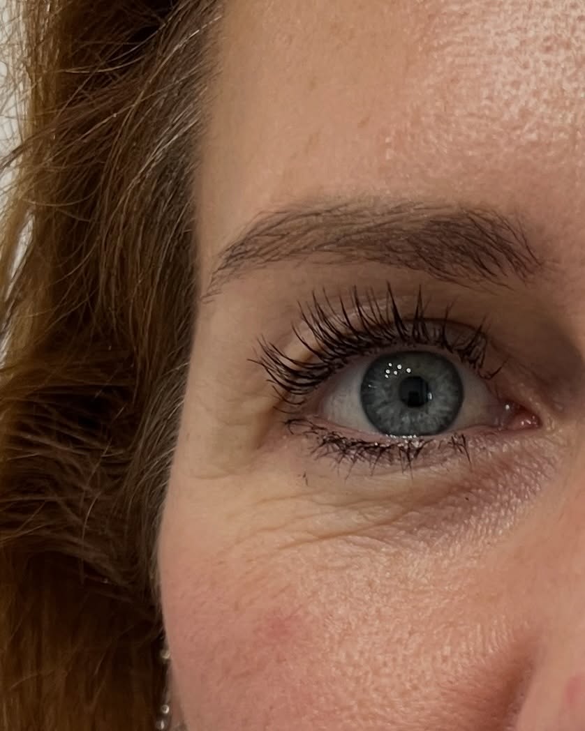 3D Lifting‼️‼️
Ergebnis nach nur einer Behandlung😱
📌 schmerzfrei
📌 langanhaltendes Ergebnis
📌 stopp den Alterungsprozess
📌 reduziert Fältchen
📌 liftet die hängenden Wangen nach oben
📌 straft die Oberlider
📌 lässt dich 5-10 Jahre jünger aussehen
Vereinbare jetzt dein Termin, um frischer, jünger und etwas straffer auszusehen.
beauty agent
Mundsburger Damm 35
22087 Hamburg
☎️ 01788877911
#noninvasivetreatments #facelift #facelifting #straffehaut #deutschland