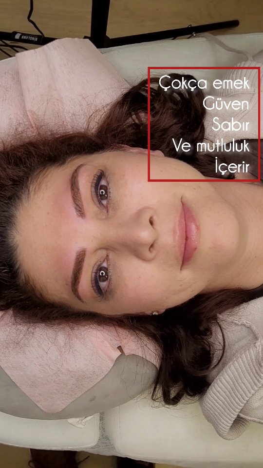 Bu uygulamam bolca güven, sabır, emek ve mutluluk içerir.
Canım danışanımın farklı bir merkezde yaptırdığı ve hiç memnun olmadığı bir kaş uygulaması vardı. Hatta istemesine rağmen tazeletmek için korkuyordu.
Yollarımız kesişti. İyi ki de kesişti.
Kendisinin bu süreçte bana duyduğu güvene, gösterdiği sabıra çok çok teşekkür ederim.
Belirtmek isterim ki eski işlemli kaşlarda, eski pigmentin yapısı, yeni verilen pigmenti kabul etmeyebiliyor. O sebeple iyileşme süreçlerinde hep iletişimde olmak ve sonraki seansı beklemek danışanım açısından güven gerektiren bir durumdu.
Sonucunda danışanımı mutlu gören ben, daha da mutlu oluyorum.
Yüzünüz değerlidir.
Lütfen seçici olun.
Uygulamalarım hakkında sorunuz olursa lütfen rahatlıkla ulaşın.
.
.
.
.
.
.
.
#kalicikaş #kalıcıkaş #kalıcıdudak