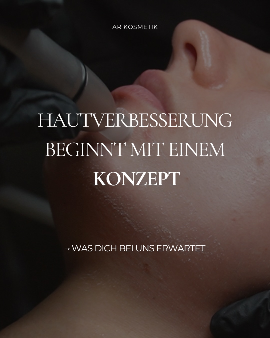 Hautverbesserung beginnt nicht mit einer einzelnen Behandlung, sondern mit einem fundierten Konzept. 🔎
Bei uns erhält deine Haut ausschließlich das, was sie tatsächlich benötigt. Ergebnisse sind kein Zufall – sie sind das Resultat von Struktur, Zeit und Geduld.
Schwankungen, Rückfälle und vorübergehende Stagnation gehören zum Hautprozess, bis sich die Haut nachhaltig reguliert. Der zentrale Baustein dabei ist die Heimpflegeroutine. Nur durch die tägliche, gezielte Versorgung können die Hautmechanismen effektiv arbeiten.
Behandlungen unterstützen diesen Prozess, ersetzen ihn jedoch nicht.
Ein vorhandenes Budget wird berücksichtigt – wir entwickeln eine individuelle Routine, die realistisch umsetzbar ist. Keine leeren Versprechen, sondern evidenzbasierte Hautpflege.
Wenn du Haut verstehen willst, statt sie nur zu behandeln, bist du bei uns richtig - Buche jetzt.
#kosmetikstudiomünchen #revidermmünchen #mesoestetic #arkosmetikmünchen #hydrafacialmünchen #ästhetik