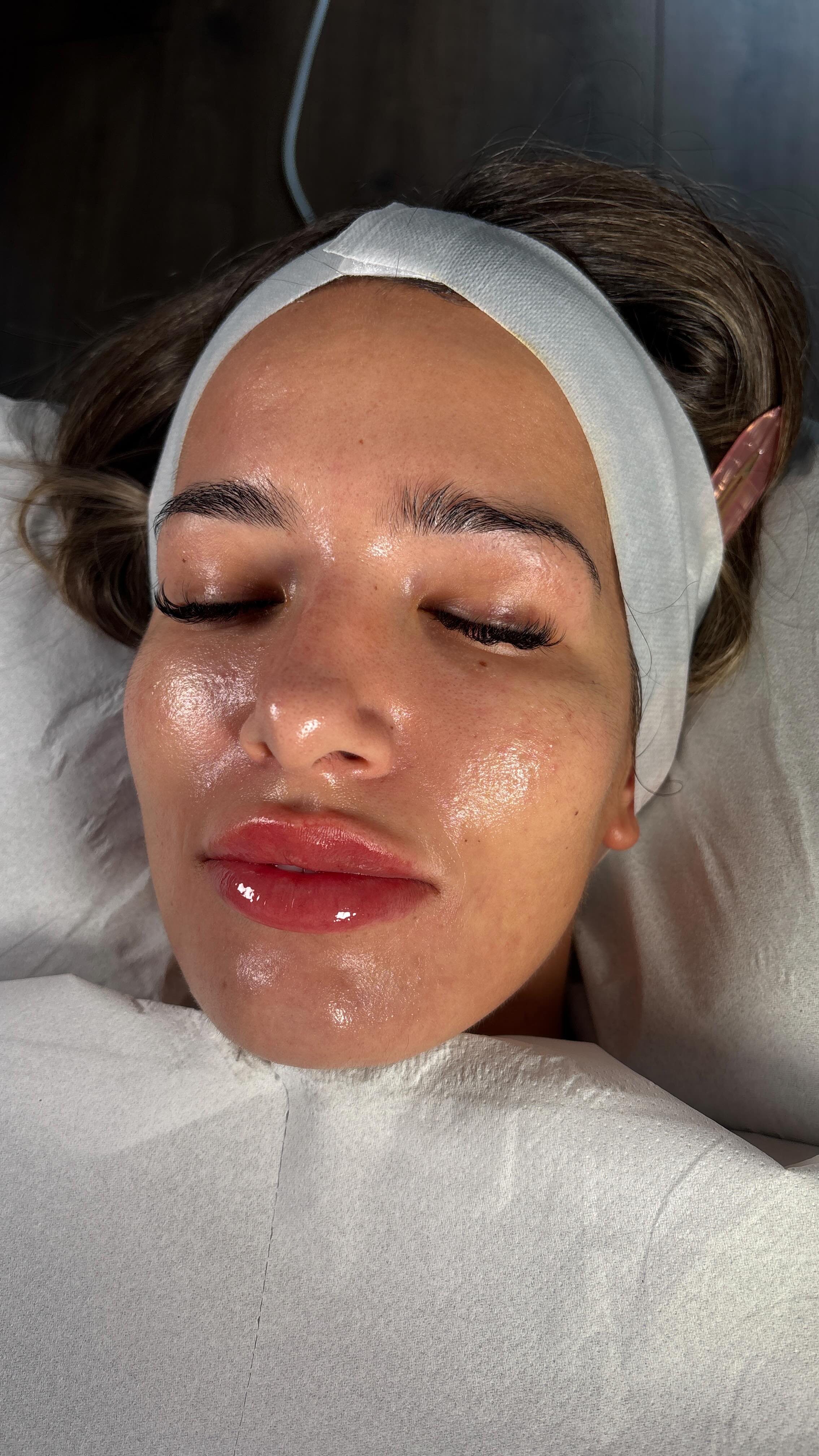 Not even 4 weeks to go ✨ get your Christmas glow in the next week to be all healed and glowy in time for the big day 🎅