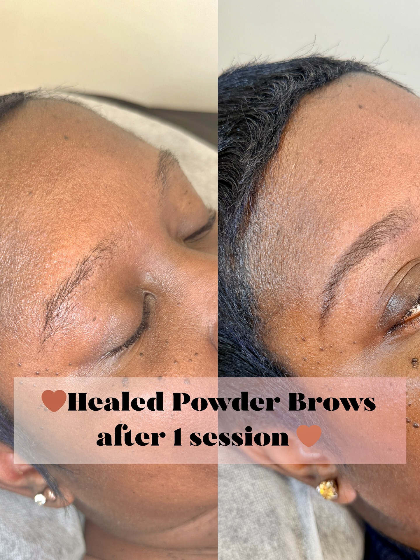 The softest healed powder brows ๐คโจ