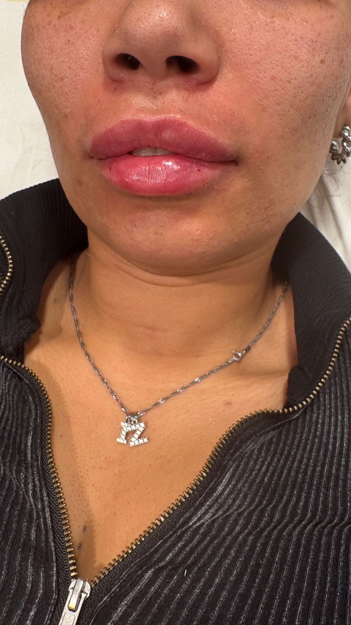 Don’t forget your qualification 🥰📈 #ampikasaesthetics #aesthetics #aestheticstrainingacademy #aestheticstraining #aestheticstrainingcourses